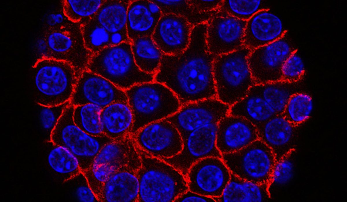 Genetically Engineered Immune Cells Eradicate Solid Tumors in Mice