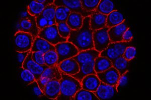 Genetically Engineered Immune Cells Eradicate Solid Tumors in Mice