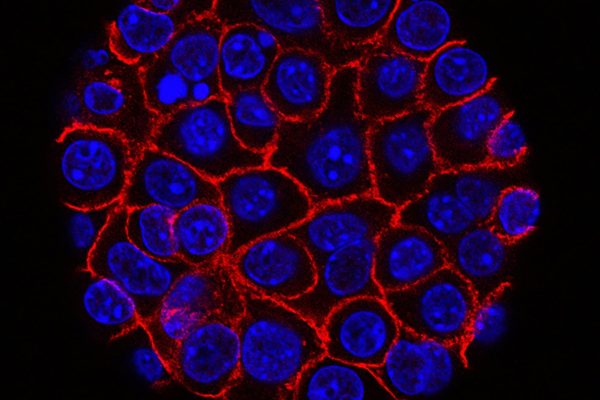 Genetically Engineered Immune Cells Eradicate Solid Tumors in Mice